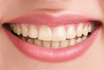 Close-up of a person's smile showing natural teeth and pink lips in a dental care context.