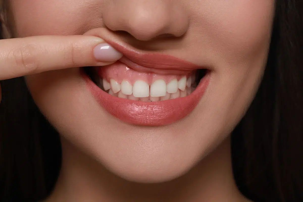 Why Gums Bleed and Why It Is a Signal to Improve, Not Stop, Oral Hygiene